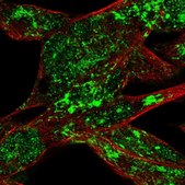Anti-RPS6KA6 antibody produced in rabbit Ab1, Prestige Antibodies® Powered by Atlas Antibodies, affinity isolated antibody, buffered aqueous glycerol solution
