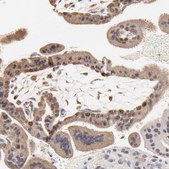 Anti-BIRC5 antibody produced in rabbit Prestige Antibodies® Powered by Atlas Antibodies, affinity isolated antibody, buffered aqueous glycerol solution