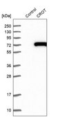 Anti-CROT antibody produced in rabbit Prestige Antibodies® Powered by Atlas Antibodies, affinity isolated antibody, buffered aqueous glycerol solution, Ab2