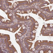 Anti-STAM antibody produced in rabbit Prestige Antibodies® Powered by Atlas Antibodies, affinity isolated antibody, buffered aqueous glycerol solution