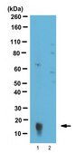 Anti-FABP1 Antibody serum, from rabbit