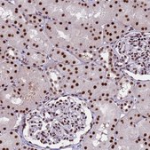 Anti-THOC2 antibody produced in rabbit Prestige Antibodies® Powered by Atlas Antibodies, affinity isolated antibody, buffered aqueous glycerol solution