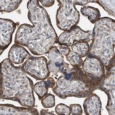 Anti-TRIM38 antibody produced in rabbit Prestige Antibodies® Powered by Atlas Antibodies, affinity isolated antibody, buffered aqueous glycerol solution