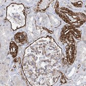 Anti-UBTD1 antibody produced in rabbit Prestige Antibodies® Powered by Atlas Antibodies, affinity isolated antibody, buffered aqueous glycerol solution