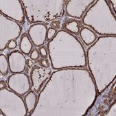 Monoclonal Anti-PDIA3 antibody produced in mouse Prestige Antibodies® Powered by Atlas Antibodies, clone CL2444, purified immunoglobulin, buffered aqueous glycerol solution