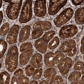 Anti-TRIM16 antibody produced in rabbit Prestige Antibodies® Powered by Atlas Antibodies, affinity isolated antibody, buffered aqueous glycerol solution