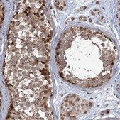 Anti-PHC3 antibody produced in rabbit Prestige Antibodies® Powered by Atlas Antibodies, affinity isolated antibody, buffered aqueous glycerol solution