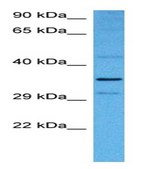 Anti-NFKBIB antibody produced in rabbit affinity isolated antibody