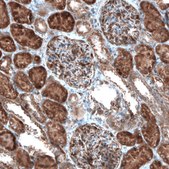 Anti-CAMTA1 antibody produced in rabbit Prestige Antibodies® Powered by Atlas Antibodies, affinity isolated antibody, buffered aqueous glycerol solution