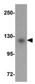 Anti-USP10 Antibody from rabbit, purified by affinity chromatography