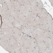 Anti-EHBP1 antibody produced in rabbit Prestige Antibodies® Powered by Atlas Antibodies, affinity isolated antibody, buffered aqueous glycerol solution