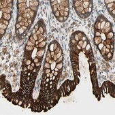 Anti-SKIL antibody produced in rabbit Prestige Antibodies® Powered by Atlas Antibodies, affinity isolated antibody, buffered aqueous glycerol solution