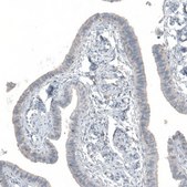 Anti-KNSTRN antibody produced in rabbit Prestige Antibodies® Powered by Atlas Antibodies, affinity isolated antibody, buffered aqueous glycerol solution