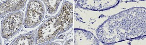 Anti-BubR1 Antibody, clone 1D23 ZooMAb® Rabbit Monoclonal recombinant, expressed in HEK 293 cells