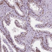 Anti-C1orf112 antibody produced in rabbit Prestige Antibodies® Powered by Atlas Antibodies, affinity isolated antibody, buffered aqueous glycerol solution, Ab1