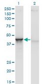 Monoclonal Anti-ACY1 antibody produced in mouse clone 4F1-B7, purified immunoglobulin, buffered aqueous solution