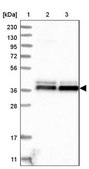 Anti-NDE1 antibody produced in rabbit Prestige Antibodies® Powered by Atlas Antibodies, affinity isolated antibody, buffered aqueous glycerol solution