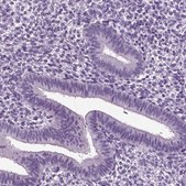 Anti-DEFB118 antibody produced in rabbit Prestige Antibodies® Powered by Atlas Antibodies, affinity isolated antibody, buffered aqueous glycerol solution
