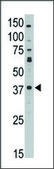 Anti-MAGEA10 (C-term) antibody produced in rabbit IgG fraction of antiserum, buffered aqueous solution