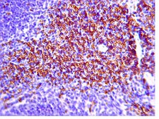Anti-IL-23R Antibody, cytoplasmic from rabbit, purified by affinity chromatography