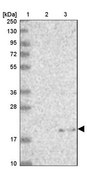 Anti-MRPL22 antibody produced in rabbit Prestige Antibodies® Powered by Atlas Antibodies, affinity isolated antibody, buffered aqueous glycerol solution