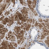 Anti-LPP antibody produced in rabbit Prestige Antibodies® Powered by Atlas Antibodies, affinity isolated antibody, buffered aqueous glycerol solution