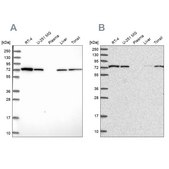 Anti-SNX1 antibody produced in rabbit Prestige Antibodies® Powered by Atlas Antibodies, affinity isolated antibody, buffered aqueous glycerol solution