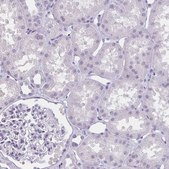 Anti-MOBP antibody produced in rabbit Prestige Antibodies® Powered by Atlas Antibodies, affinity isolated antibody, buffered aqueous glycerol solution