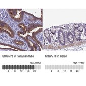 Anti-SRGAP3 antibody produced in rabbit Prestige Antibodies® Powered by Atlas Antibodies, affinity isolated antibody, buffered aqueous glycerol solution