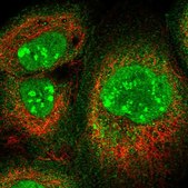 Anti-CD3EAP antibody produced in rabbit Prestige Antibodies® Powered by Atlas Antibodies, affinity isolated antibody, buffered aqueous glycerol solution