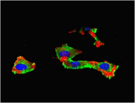 Anti-IGF-IR&#945; subunit Antibody from chicken, purified by affinity chromatography