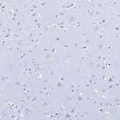 Anti-DLK1 antibody produced in rabbit Prestige Antibodies® Powered by Atlas Antibodies, affinity isolated antibody, buffered aqueous glycerol solution