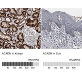 Anti-ACADM antibody produced in rabbit Prestige Antibodies® Powered by Atlas Antibodies, affinity isolated antibody, buffered aqueous glycerol solution