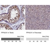 Anti-PPHLN1 antibody produced in rabbit Prestige Antibodies® Powered by Atlas Antibodies, affinity isolated antibody, buffered aqueous glycerol solution