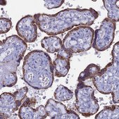 Anti-ACSS1 antibody produced in rabbit Prestige Antibodies® Powered by Atlas Antibodies, affinity isolated antibody, buffered aqueous glycerol solution