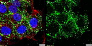 Anti-Profilin-1 Antibody, clone 1H21 ZooMAb® Rabbit Monoclonal recombinant, expressed in HEK 293 cells