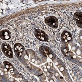Anti-GUCY1B3 antibody produced in rabbit Prestige Antibodies® Powered by Atlas Antibodies, affinity isolated antibody, buffered aqueous glycerol solution
