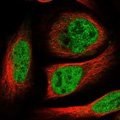 Anti-HOXC5 antibody produced in rabbit Prestige Antibodies® Powered by Atlas Antibodies, affinity isolated antibody, buffered aqueous glycerol solution