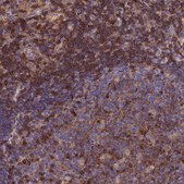 Anti-SEPT9 antibody produced in rabbit Prestige Antibodies® Powered by Atlas Antibodies, affinity isolated antibody, buffered aqueous glycerol solution