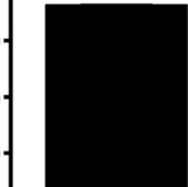 Anti-ODF2 antibody produced in rabbit Prestige Antibodies® Powered by Atlas Antibodies, affinity isolated antibody, buffered aqueous glycerol solution