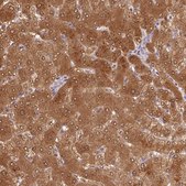 Anti-ALDH8A1 antibody produced in rabbit Prestige Antibodies® Powered by Atlas Antibodies, affinity isolated antibody, buffered aqueous glycerol solution