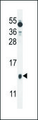 ANTI-BEX1 (CENTER) antibody produced in rabbit IgG fraction of antiserum, buffered aqueous solution