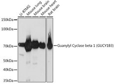 Anti-Guanylyl Cyclase beta 1 (GUCY1B3) antibody produced in rabbit