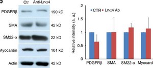 Anti-actina, α-músculo liso monoclonal clone 1A4, purified from hybridoma cell culture