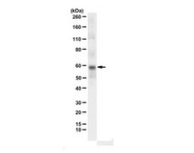 Anti-Dyskerin (Sheep) from sheep, purified by affinity chromatography ...