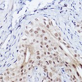 Anti-SSCA1/SerpinB3 Antibody, clone 6J3U6, Rabbit Monoclonal