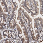 Anti-CASP3 antibody produced in rabbit Prestige Antibodies® Powered by Atlas Antibodies, affinity isolated antibody, buffered aqueous glycerol solution