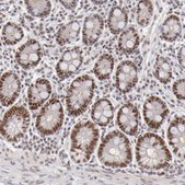 Anti-TFAP4 antibody produced in rabbit Prestige Antibodies® Powered by Atlas Antibodies, affinity isolated antibody, buffered aqueous glycerol solution