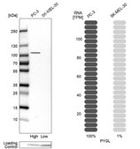 Anti-PYGL antibody produced in rabbit Prestige Antibodies® Powered by Atlas Antibodies, affinity isolated antibody, buffered aqueous glycerol solution