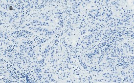 Anti-Bax Antibody, clone 1C7, ZooMAb® Rabbit Monoclonal recombinant, expressed in HEK 293 cells